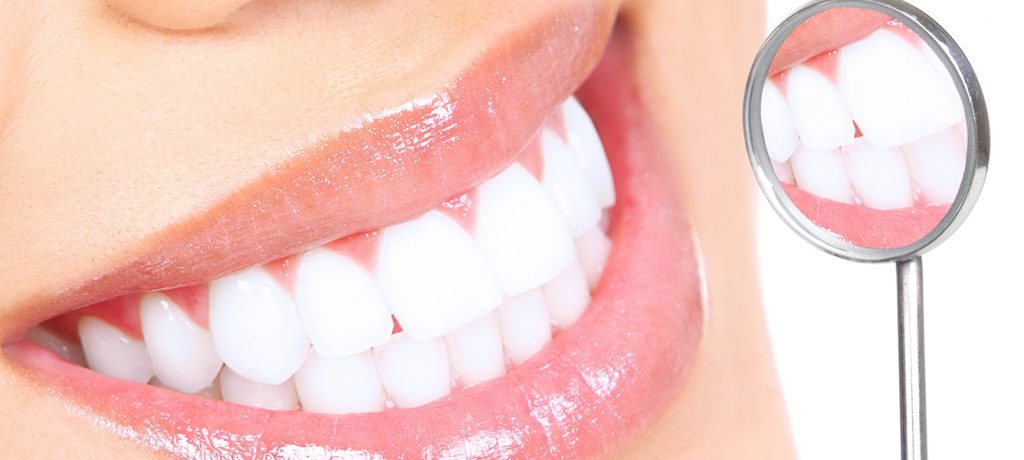 How Do I Keep My Teeth White?