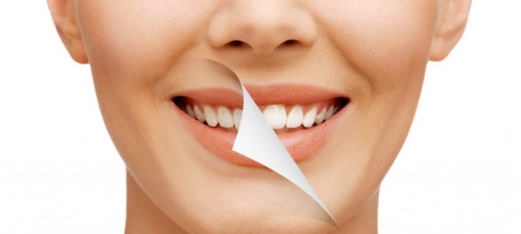 The Connection between 50 Shades and Whitening Your Teeth