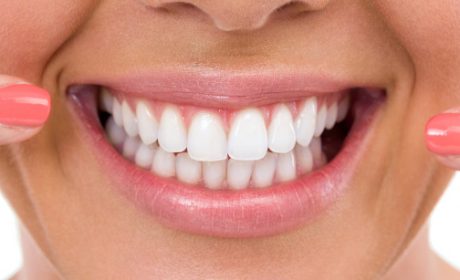 3 Reasons to Consider Sensitive Teeth Whitening