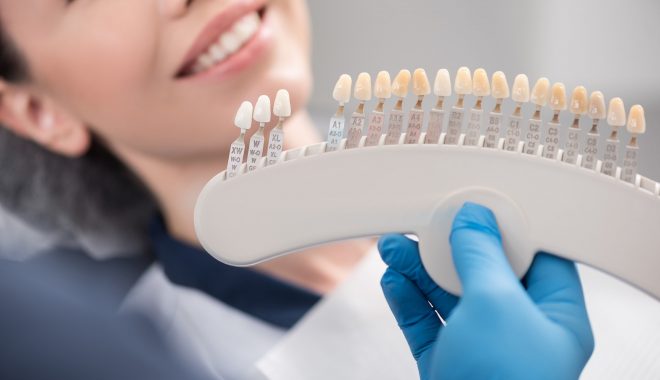 What Are My Cosmetic Dentistry Options?
