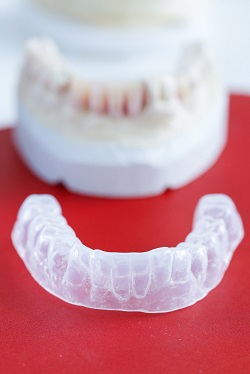 what does invisalign do