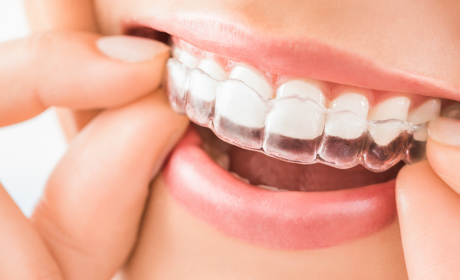 Check Out These Invisalign Before and After Pictures to See Amazing Results!