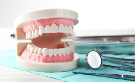 U Penn Dental Practice Gives You 5 Ways You Can Prevent Cavities