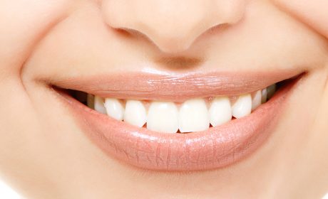 How To Straighten My Teeth: 3 Clever Ways To Achieve Your Best Smile