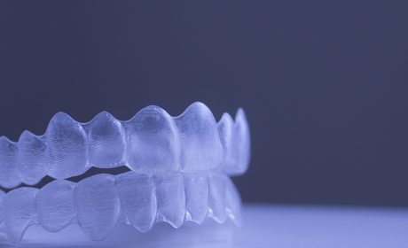 How Long Do Invisible Braces Take To Improve Your Teen's Smile?