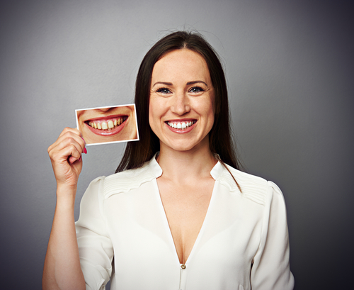 Blog Teeth Whiteneing Body image 4-17