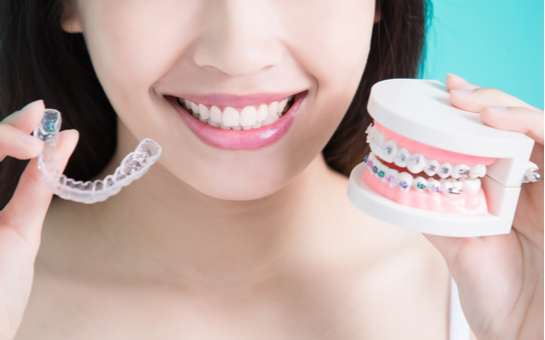 bản trình diễn invisalign