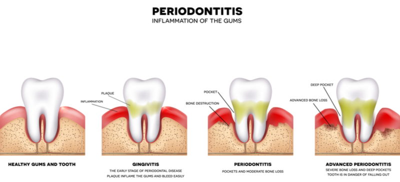 what is a periodontist dentist