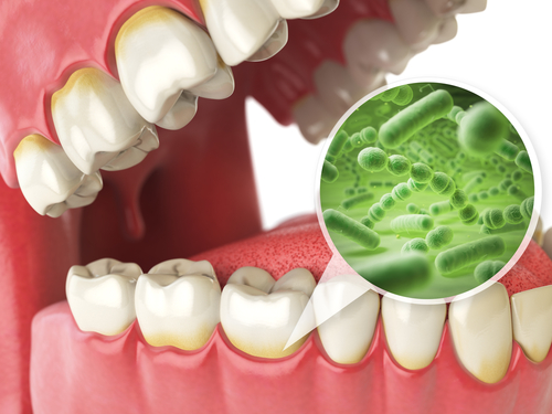 tooth infection symptoms