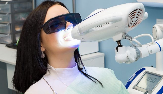 Are All Teeth Whitening Systems The Same?