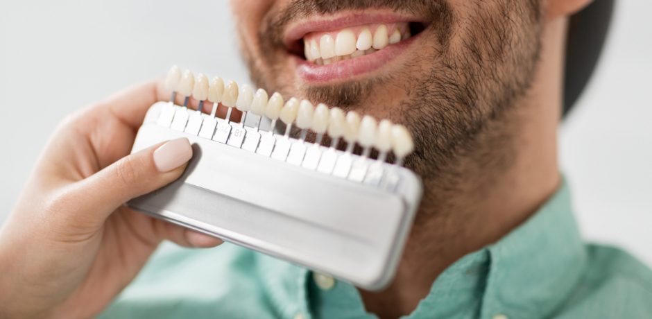 Pros and Cons of the Cost of Dental Veneers