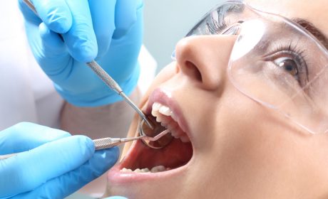 "Does a Root Canal Hurt?" and Other FAQs on Endodontic Treatment
