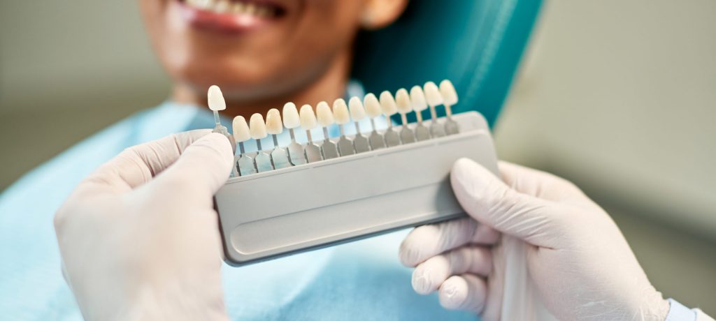 What Are Veneers, and Are They Right for You?