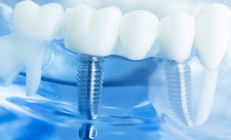 An Insider’s View: Penn Oral Surgeons
