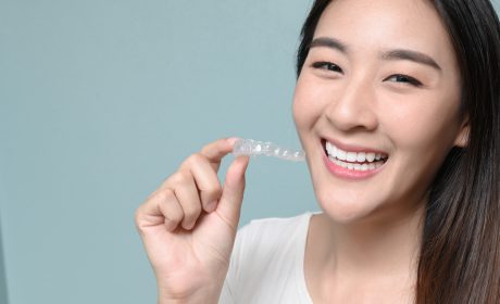 Why Should Patients Consider Clear Aligners if They Haven’t Before?