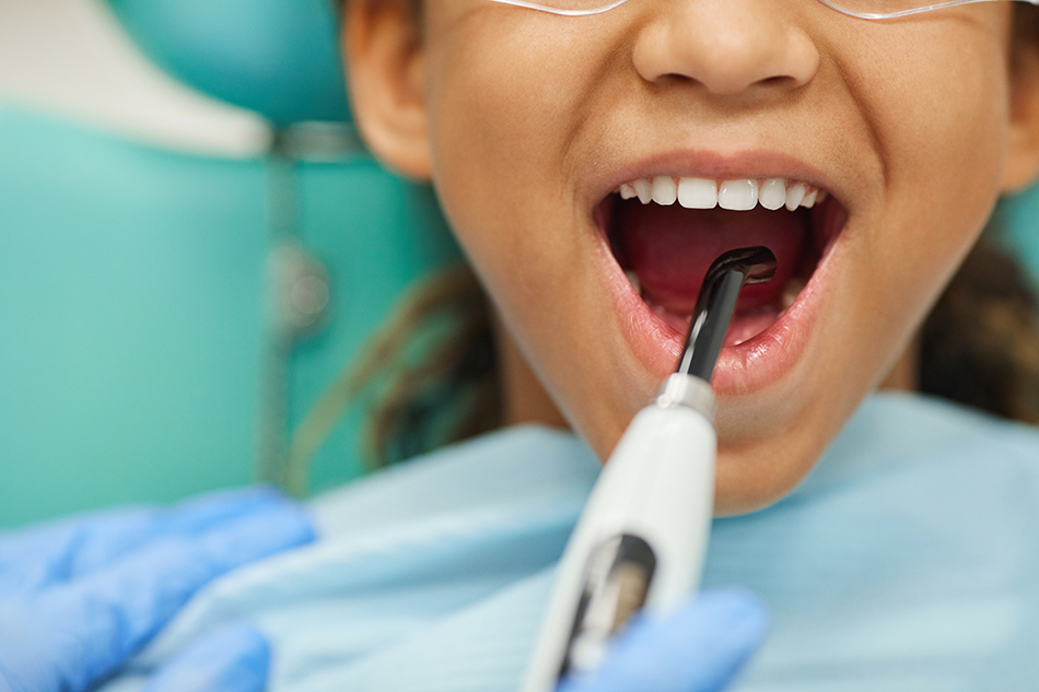 Gloved dentist holds a dental vacuum inside a young girl’s open mouth during dental procedures.