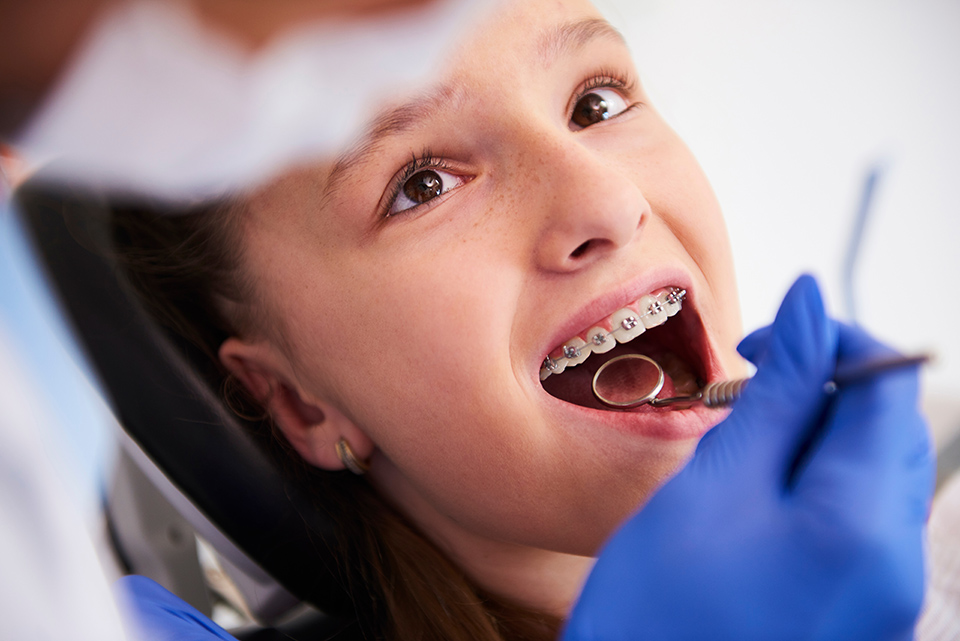 Young girl with braces looks up at the orthodontist during a dental exam. 