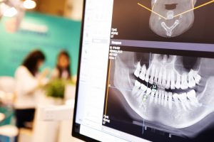 Digital X-ray of the teeth and jaw on a computer screen. 