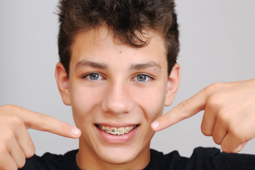  A pretty teenager on a gray background. He points his fingers of both hands on braces on his teeth and smiles.