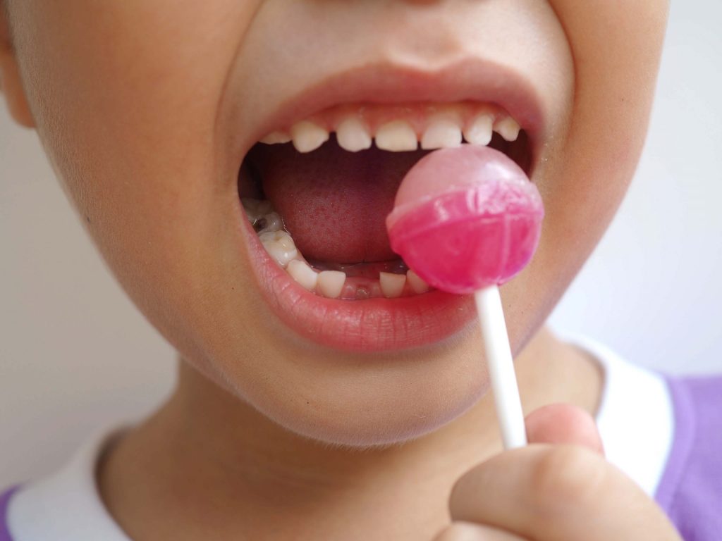 Treating Tooth Decay In Children Penn Dental Family Practice   Shutterstock 2135603635 Scaled 1024x768 