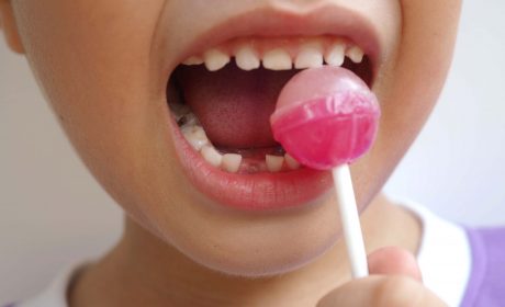 Preventing Tooth Decay in Children