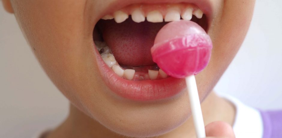 Preventing Tooth Decay in Children