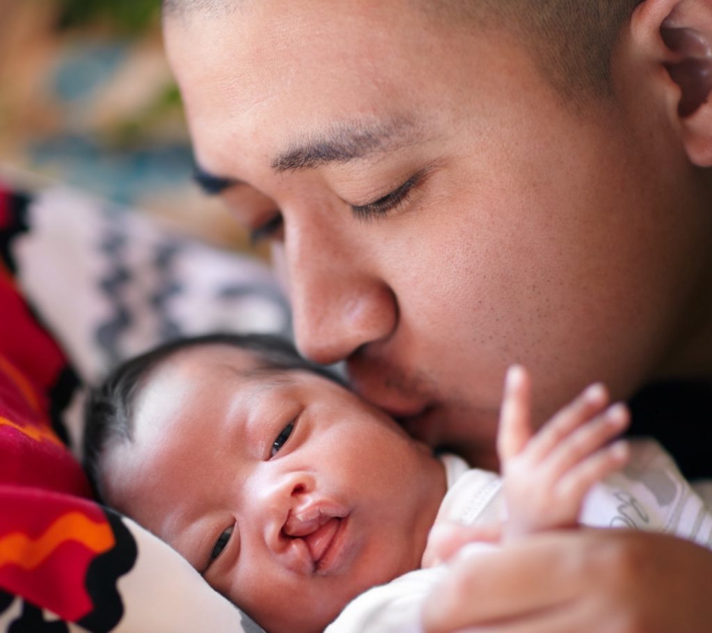 Father gently kisses the left cheek of his infant with cleft palate, who is lying on a blanket.