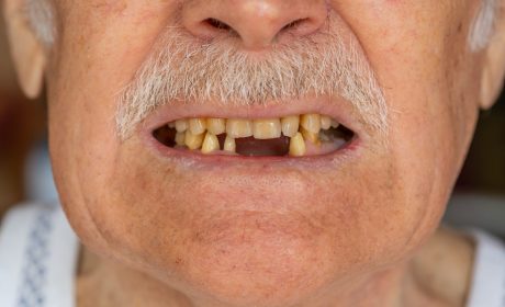 Your Step-by-Step Lost Tooth Action Plan