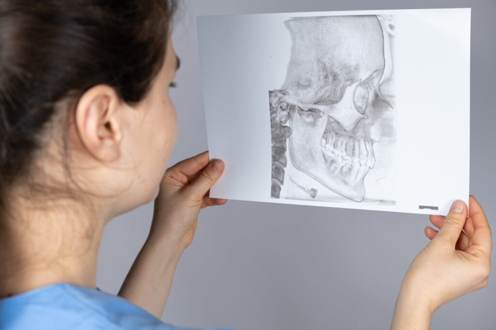 Orofacial pain specialist holds CT scan of patient who is suffering from TMJ headaches. 