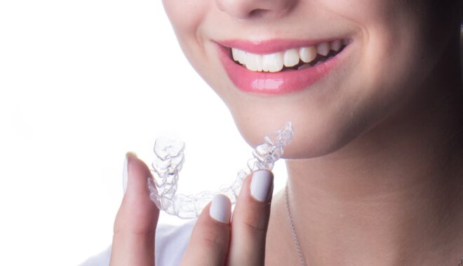 What Dental Issues Can Clear Braces Correct?