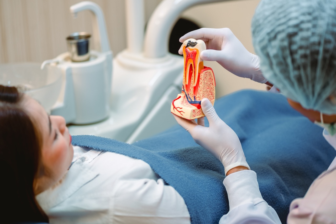 Dentist explains root canal procedure to patient, a woman reclining in dental chair, using model of tooth in gum.