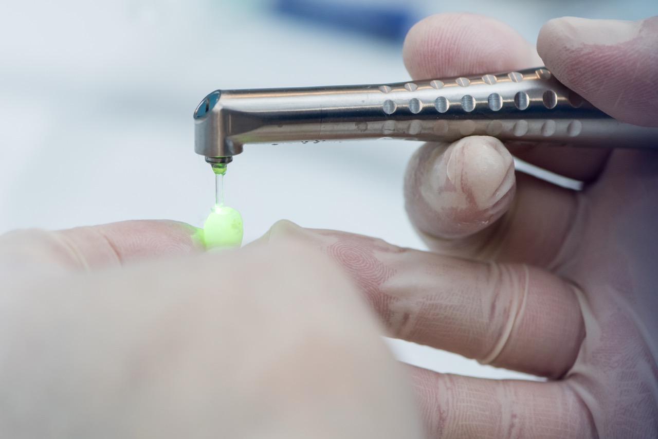 Dentist holds laser instrument in right hand, demonstrating its use on tooth held in left hand.
